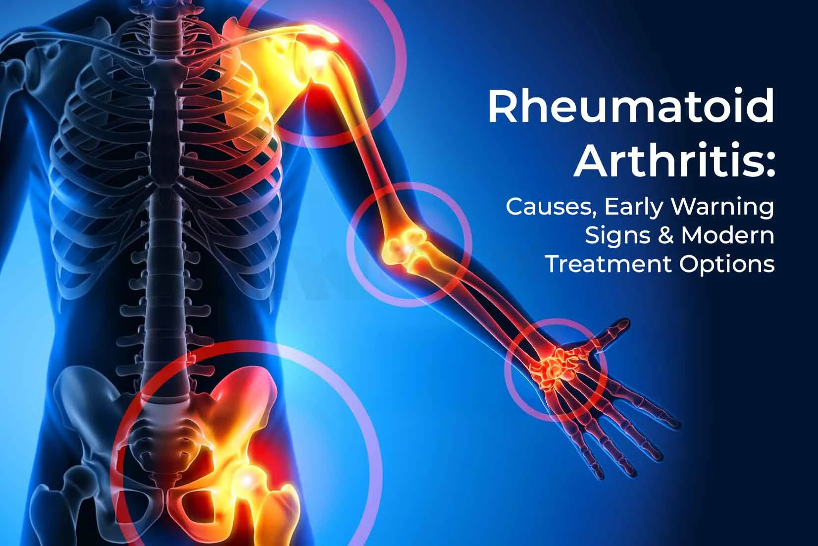 Rheumatoid Arthritis: Causes, Early Warning Signs & Modern Treatment Options Rheumatoid Arthritis: Causes, Early Warning Signs & Modern Treatment Options