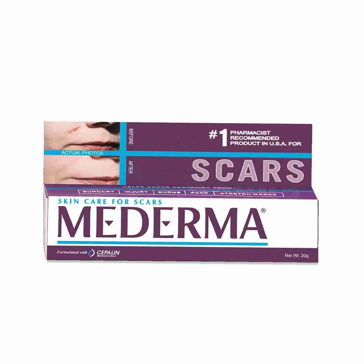 Mederma Gel (20 GM)
